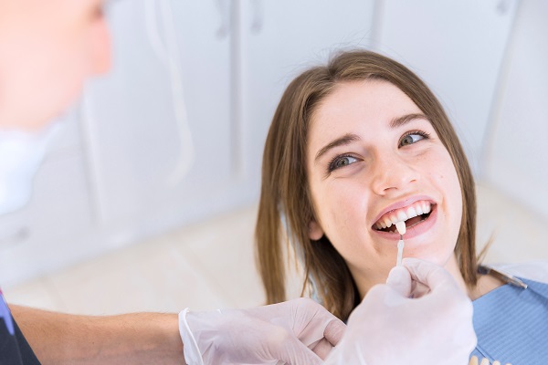 Reasons To Get Dental Veneers