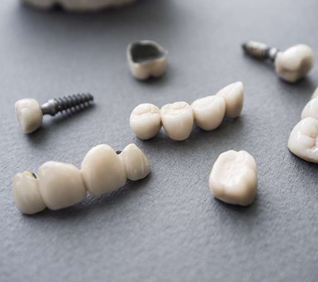 Costa Mesa The Difference Between Dental Implants and Mini Dental Implants