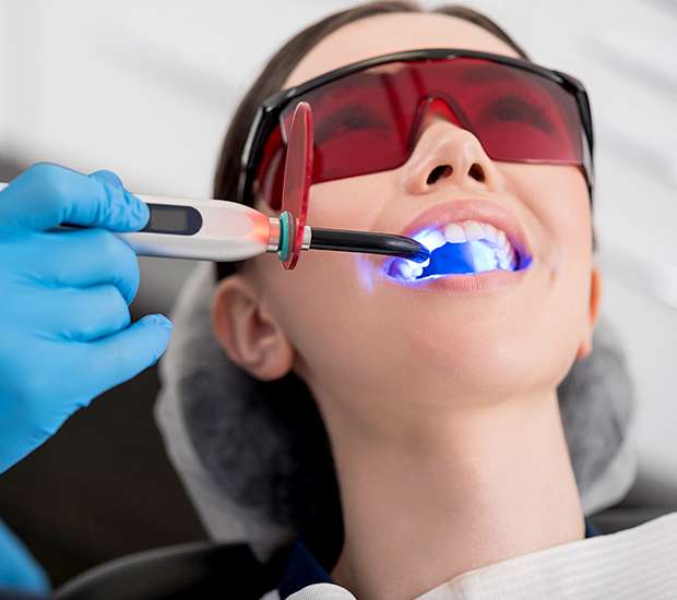 Costa Mesa Professional Teeth Whitening
