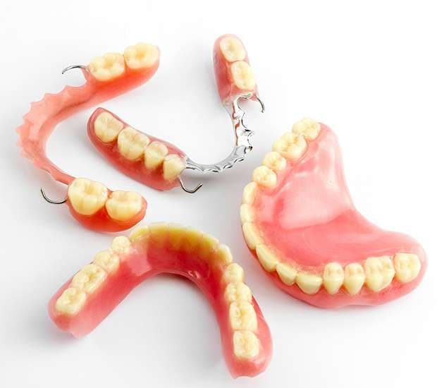 What Do I Do If I Damage My Dentures Costa Mesa, CA