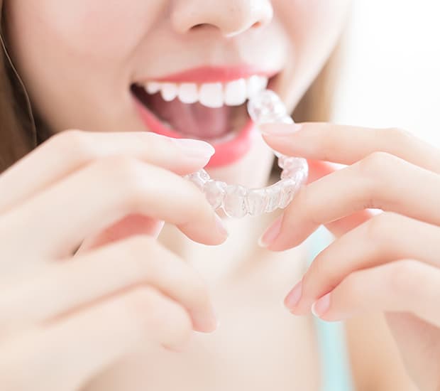 Alternative to Braces for Teens Costa Mesa, CA