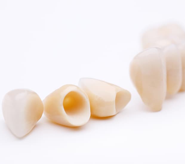 Dental Crowns Costa Mesa, CA