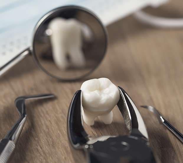 When Is a Tooth Extraction Necessary Costa Mesa, CA